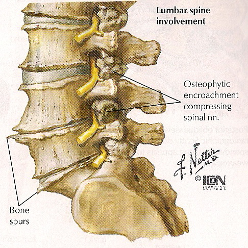 Lumbar spine anatomy - sakiswap